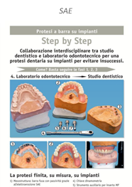 Anteprima Elettroerosione - Step by Step Collaborazione interdisciplinare tra studio dentistico e laboratorio odontotecnico
