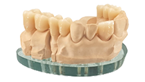 Dischi in PMMA